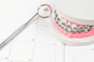 Dental model with braces on top of calendar 